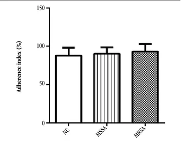 FIGURE 1 –  AI of alveolar macrophages from adult Wistar rats for the following systems:  