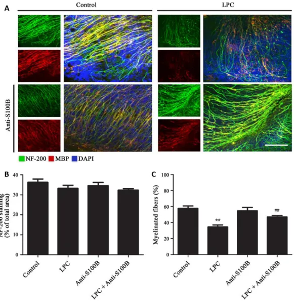 Figure  I.  5.  Blockade  of  S100B  following  demyelination  partially  prevents  loss  of  myelinated  fibers