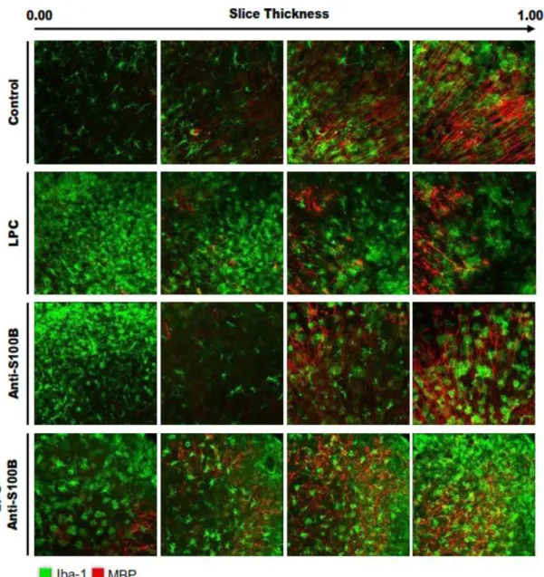 Figure  I.  6.  Blockade  of  S100B  following  demyelination  apparently  induces  microglia  migration  near  to  myelin  debris