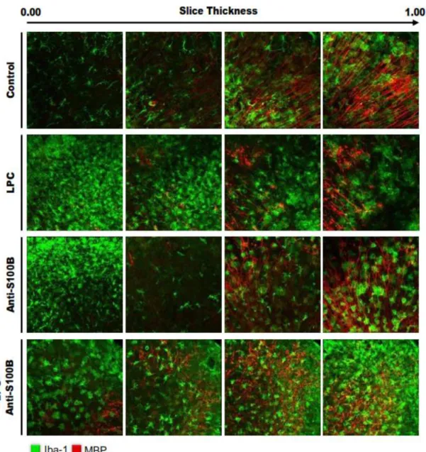 Figure  I.  6.  Blockade  of  S100B  following  demyelination  apparently  induces  microglia  migration  near  to  myelin  debris