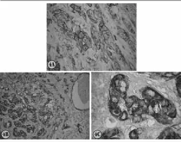 FIGURE 5 –  HEE affecting the bone tissue (HE, 20×)