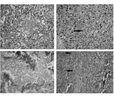 FIGURE 1  – Primary thyroid osteosarcoma: a dense, solid neoplasm with a lobulated cut  surface and chondroblastic peripheral areas