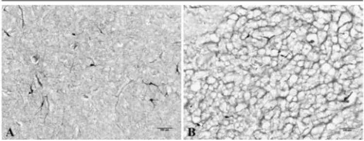 FIGURE 1 –  Microscopic appearance of freezing artifact
