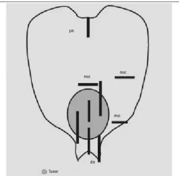 FIGURE 1  − Cleavage map for GC surgical specimens processing: sample for histological  analysis (18)