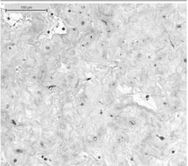 FIGURE 2  − Histological section of umbilical cord showing normal appearance of  Wharton’s jelly.