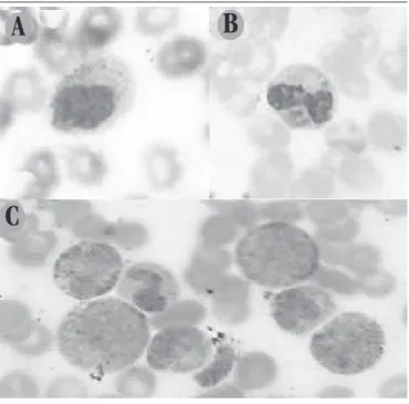 FIGURE 3 –  Photomicrograph of peripheral blood smear