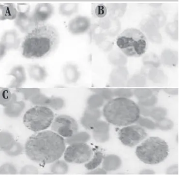 FIGURE 3 –  Photomicrograph of peripheral blood smear
