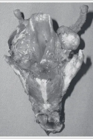 FIGURE 3 – Surgical specimen (case 2)