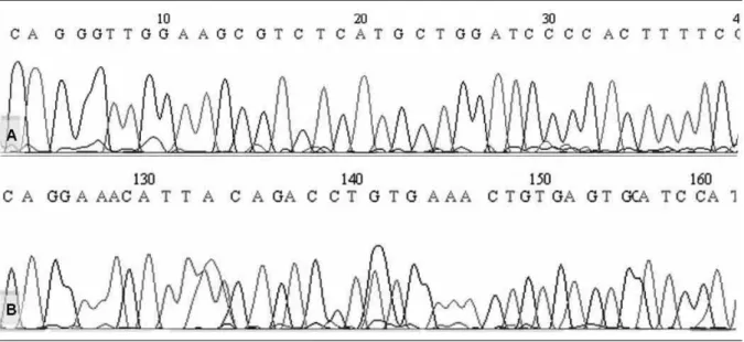 FIGURE 3 –  Segment illustrating the sequence analysis of 224-pb exon 2 PCR product by the sequencing technique