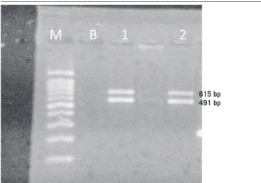 FIGURE 1  − PCR agarose gel at 1.5% for the identification of fragments 491 and 615 bp M: molecular weight marker (100 bp); B: white; line 1: sample 1; line 2: sample 2; PCR: 