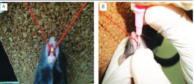 FIGURE 2 − Adapted intubation method from Hamacher et al.