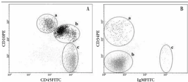 FIGURE 3  − Maturation profile of B lymphoblasts according to expression of the antigens  investigated by FC immunophenotyping