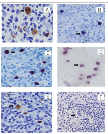 TABLE 2  − Evaluation of ISH labeled cells using Allred Score