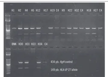 TABLE 2  − Speciic primers for HLA-B*27