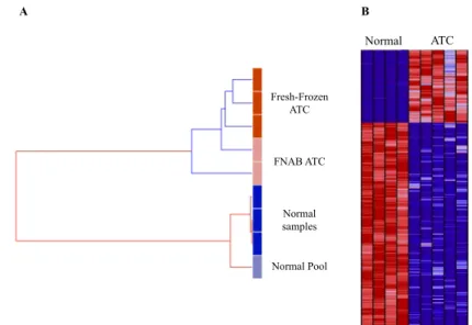 Figure  III.1  -  Analysis  of  genome-wide  expression  in  ATC. (A)  Global  gene  expression  similarity  between  samples using the unsupervised hierarchical clustering method