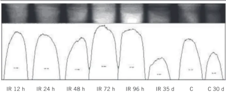 FIGURE 6  − Electrophoretic profile of SG1 proteins after whole-body exposure to 5 Gy SG1: subgroup 1.