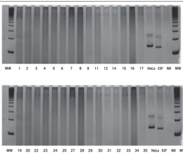 FIGURE 2 − Electrophoresis in 8% polyacrylamide gel stained with silver nitrate. HPV  amplification (142 bp)