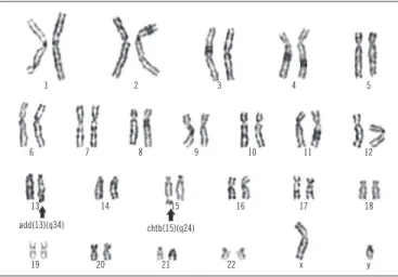 FIGURE  − Cytogenetic analysis after one year without follow-up 