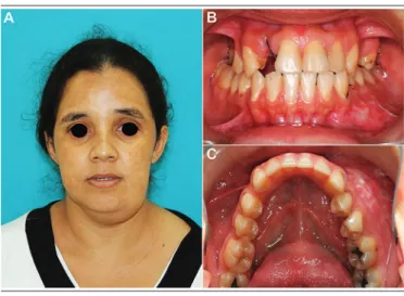 FIGURE 2  − Preoperative imaging
