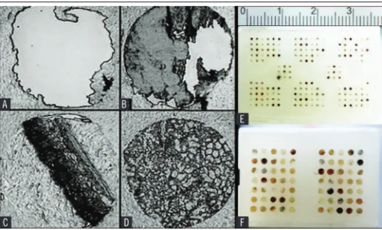 FIGURE 2  − Quality levels established for quantitative analysis of tissue samples The levels were organized in an increasing order of quality: A) value 0; B) value 1; 