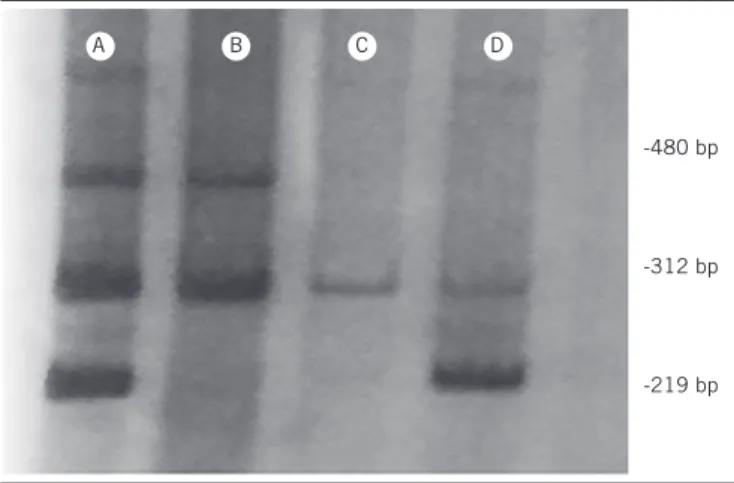 FIGURE  − Patterns of multiplex PCR for GSTT1 (480 bp), CYP1A1 (312 bp) and GSTM1  (219 bp) in a 10% polyacrylamide gel stained with silver nitrate