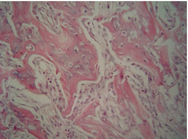 Figure 3 – Representative histological sections of isolated tibia four weeks after the  fracture