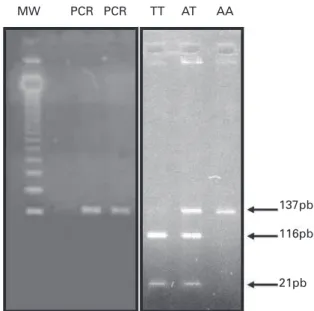 Figure 1. Electrophoresis image from a representative  sample in 3% agarose gel.