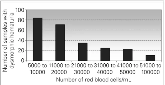Figure  1.  Dysmorphic  red  blood  cells  and  red  blood  cell casts found in the study samples.