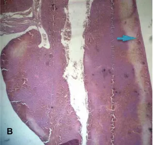 FIGURA  9  -  Fotomicrografia  do  polo  inferior  do  baço  apresentando  proliferação  vascular  intensa  (grau  3)