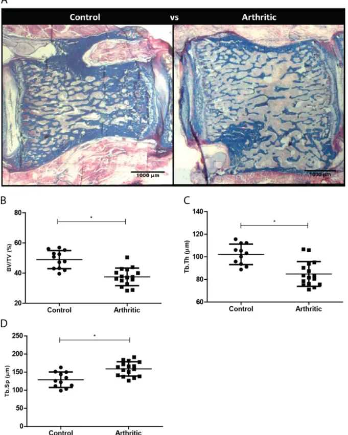 Figure 3. Bone histomorphometry assessment of the 4th lumbar vertebra (L4). Assessment of L4 in control (N = 12) and arthritic group (N = 16).