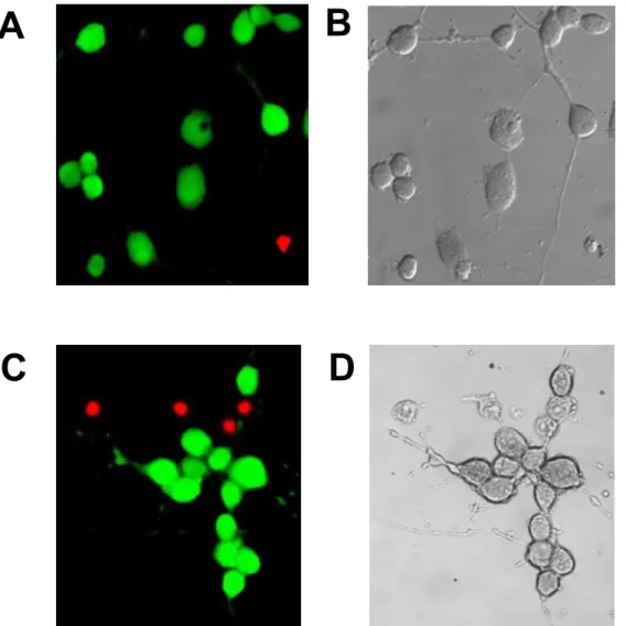 Figura 8: Imagens representativas das células SN56 antes e após o processo  isquêmico