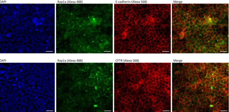 Figure 4.2-  Localization  of  endogenous  Rap1A,  CFTR and  E-cadherin  in  polarized  CFBE wt  cells