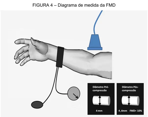 FIGURA 4 – Diagrama de medida da FMD 