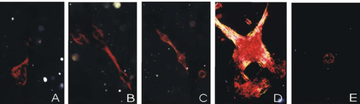 Figura  5.  Cultivo  de  CTM  da  medula  óssea  de  ratas  aos  21  dias  de  cultivo  em  meio  osteogênico,  coloração de  sob  luz  polarizada,  62,5X
