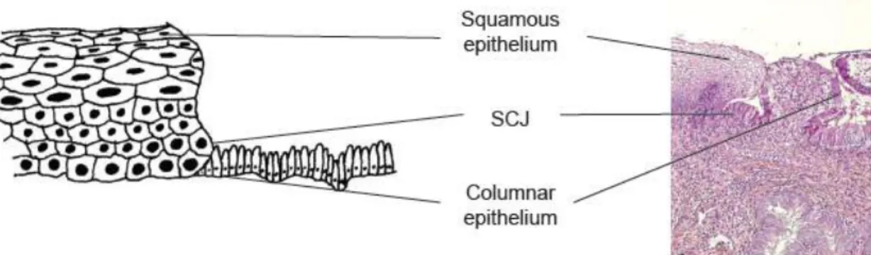 Figure 2.4: Squamocolumnar junction (SCJ). Adapted from [10].