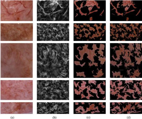 Figure 3.11: Segmentation of vasculature from cervicographic image sections. (a) Original