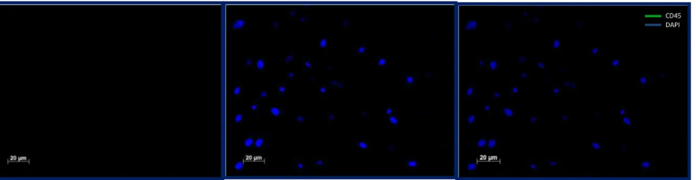 Figura 5 - Ensaio de imunocitoquímica para verificação da expressão do marcador CD45 em  células-tronco mesenquimais de medula óssea de rato Wistar