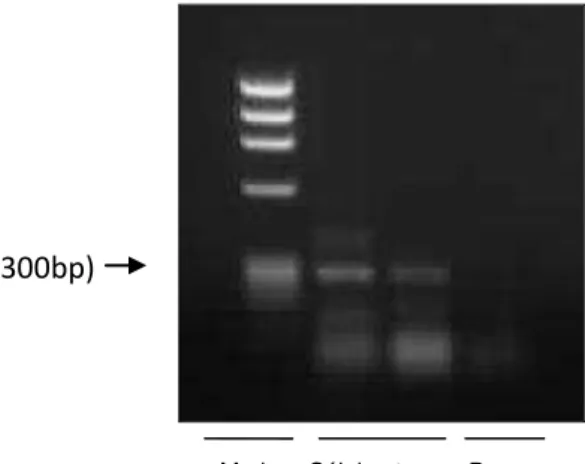 Figura  11  -  PCR  para  caracterização  da  presença  do  mRNA  do  receptor  MAS  em  células-