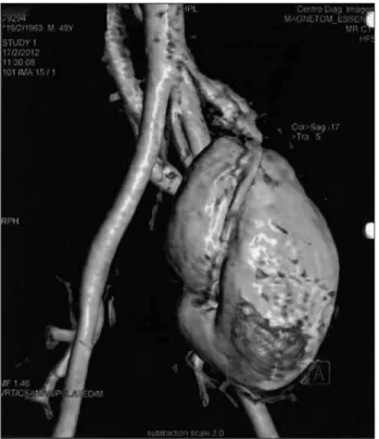 Figure 4. Magnetic resonance angiography.