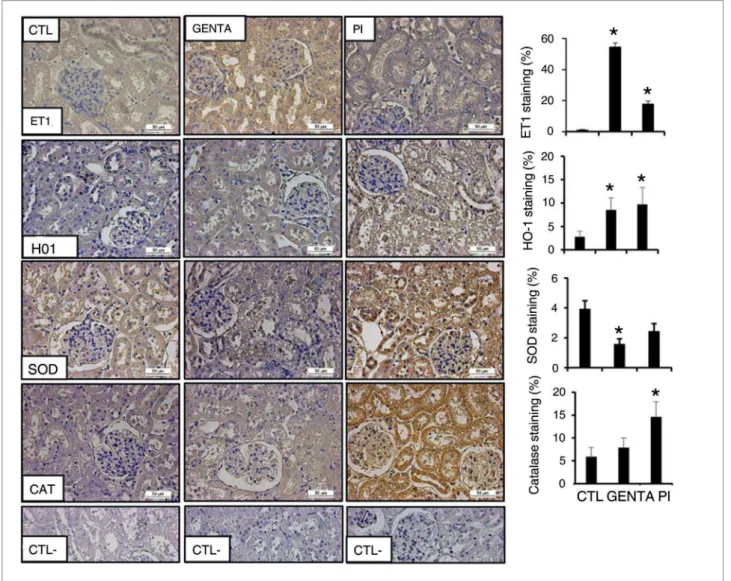 Figure 4. Histochemistry analysis. Light microscopy sections (4 µm) of kidney immunohistochemistry staining with Heme-oxygenase 1 (HO-1),  catalase (CAT), superoxide dismutase 1 (SOD) and endothelin-1 (ET-1) antibodies in control rats (CTL), animals stimul