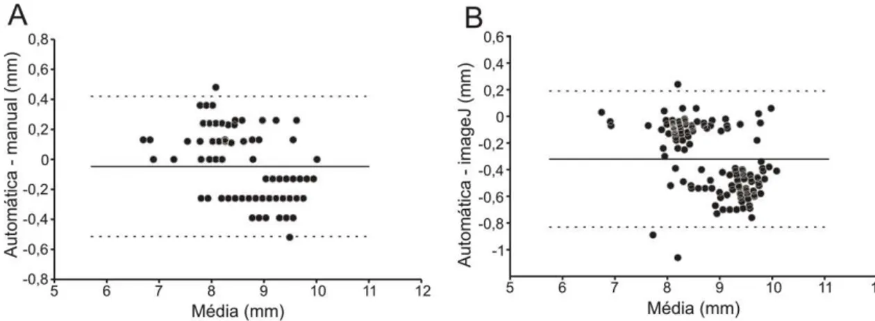 Figura  11:  Gráficos  de  Bland-Altman  utilizado  para  comparação  entre  o  diâmetro  da  pupila  calculado  automaticamente  (algoritmo  de  estimação)  e  manualmente  com  o  próprio algoritmo (A) e com o  ImageJ 1.44 (B)