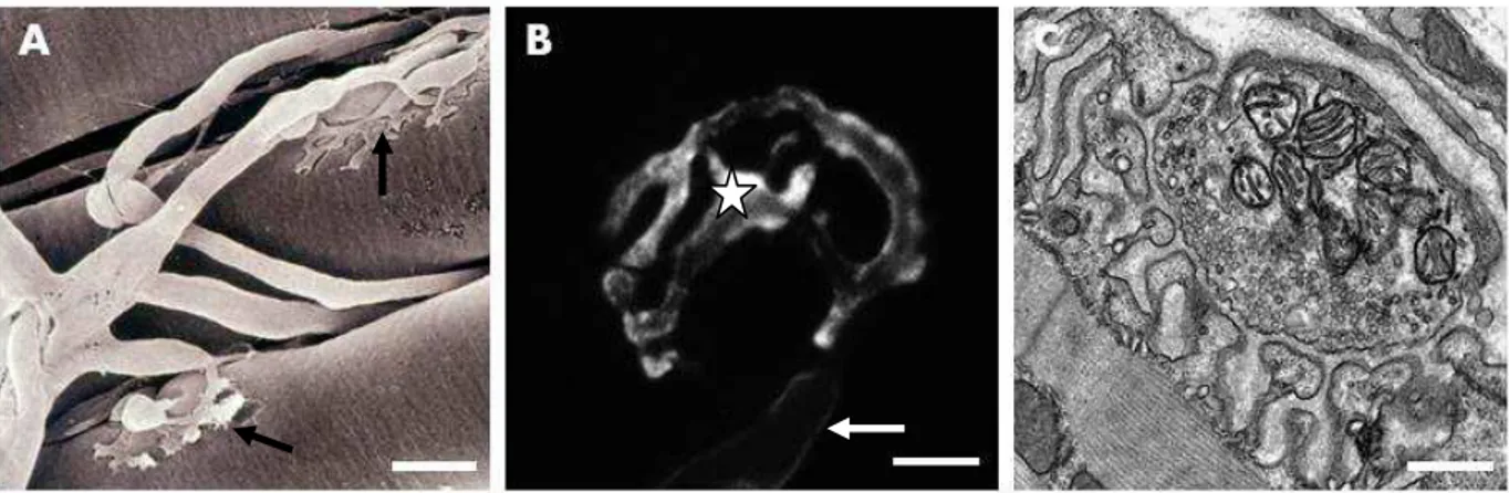 Figura  1:  Junção  Neuromuscular  de  camundongo.  (A)  Micrografia  eletrônica  de  varredura  de  JNM  de  camundongo