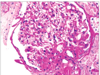 Figure 1. Putative mechanisms of action whereby obesity causes  chronic kidney disease.