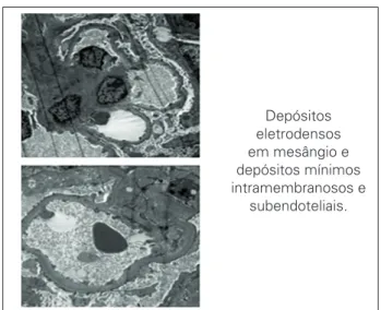 Figura 3. Microscopia eletrônica.
