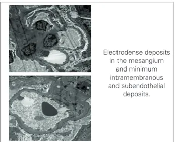 Figure 3. Electron microscopy.