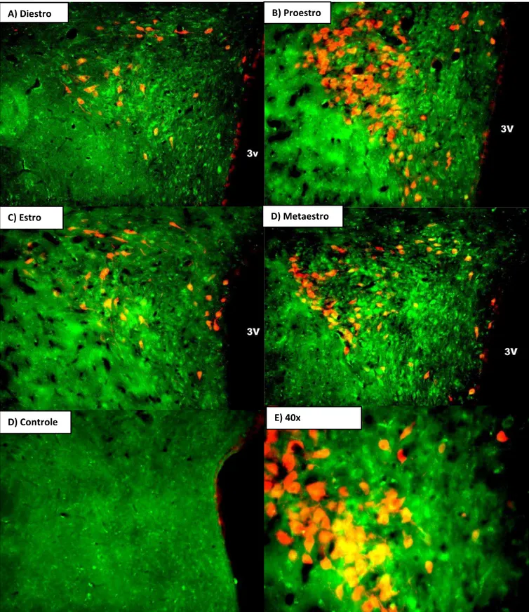 Figura  3:  Fotomicrografias  da  imunolocalização  para  GPER1  e  ocitocina  no  PVN