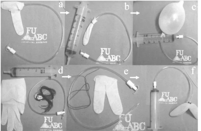 Figure 3 – Homemade dilating balloon with single (a,b,c) and double (d,e,f) glove finger.