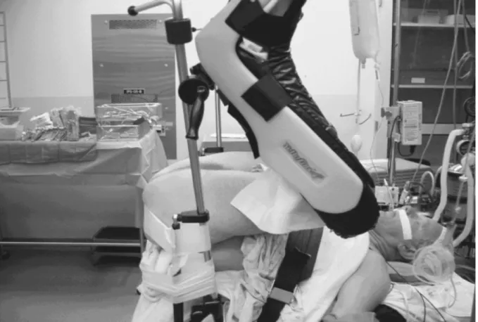 Figure 4 – The exaggerated lithotomy position for radical perineal prostatectomy.