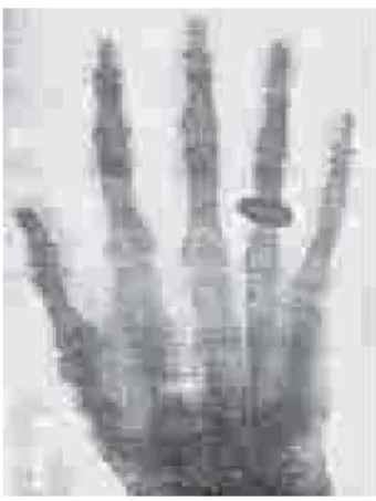 Figura 3 – A primeira radiografia da história