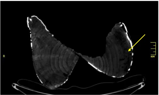 Fig. 24 - Corte transversal das pernas. Vestígios ataque de inseto.